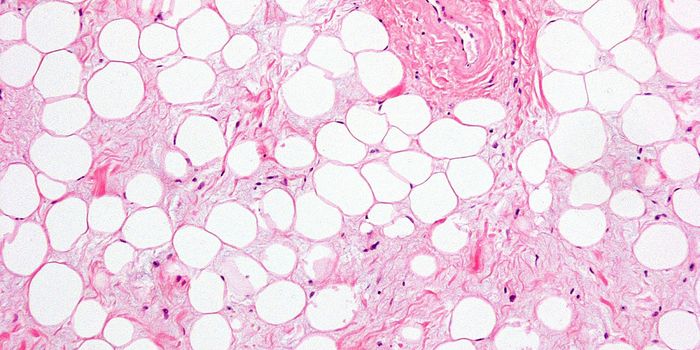 Small, Non-Coding RNA Controls Obesity-Induced Changes in Adipose Tissue