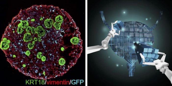 Beyond Organoids to a Better Research Model