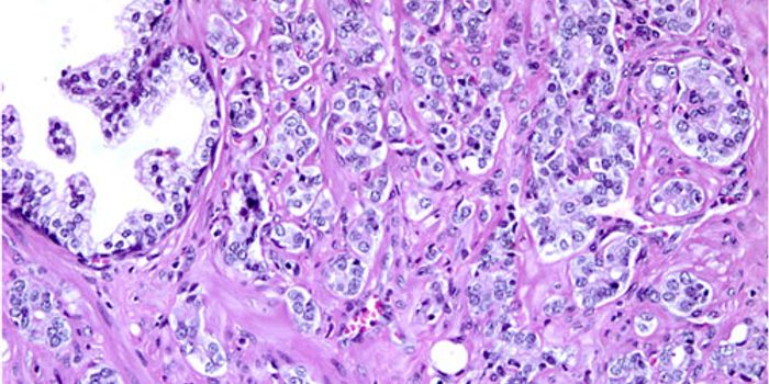 New Viable Drug Target for Prostate Cancer