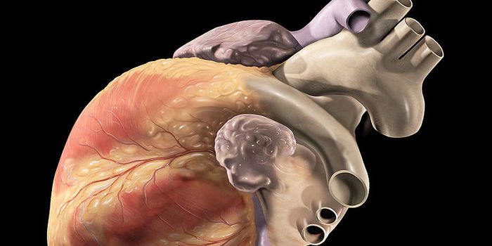 Specific Type of Fat Becomes Therapeutic Target for Heart Disease