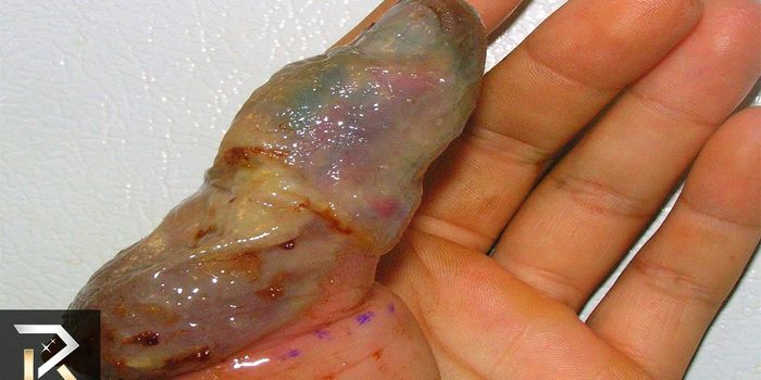 10 Bugs with the Worst Bite