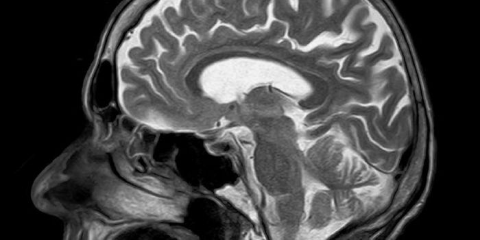 Zika: A New Weapon Against Brain Cancer?