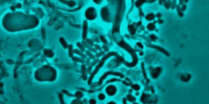 Researchers Discover a Cause of Antibiotic Resistance