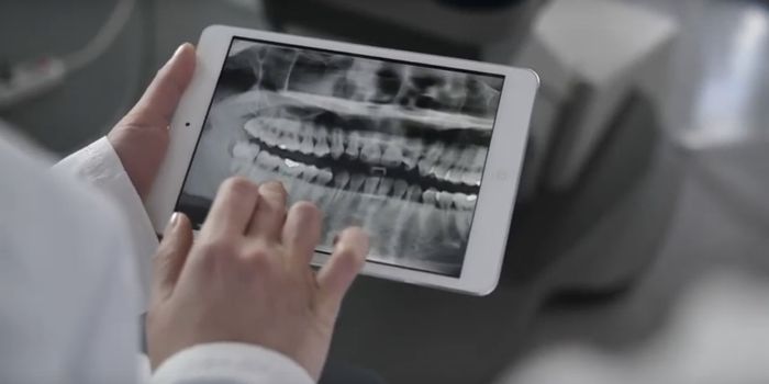 How Too Much Fluoride Can Disrupt Tooth Enamel