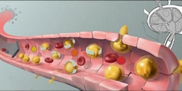 New Immunotherapy Strategy Against Lymphoma