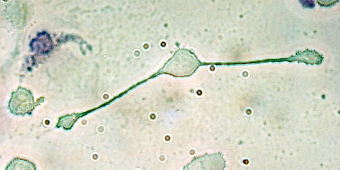 Treating Untreatable Heart Failure with Cardiac Macrophages