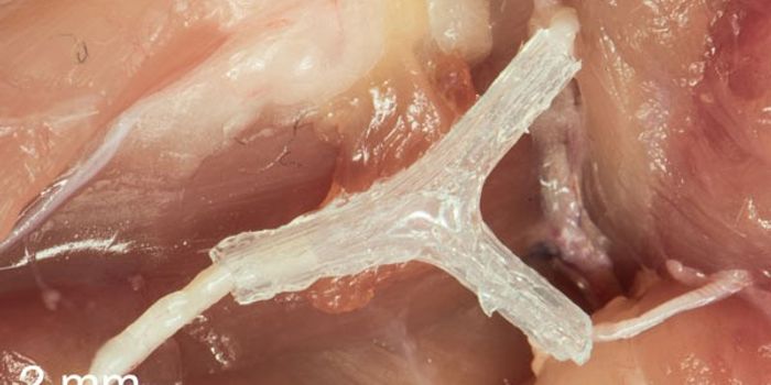 Printing New Nerve Pathways