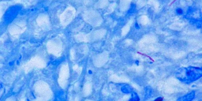 Mycobacterium Tuberculosis Playing Games with the Immune System