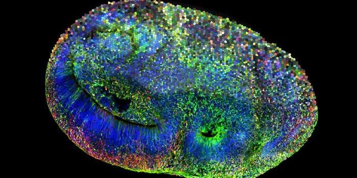 Brain Organoids Reveal Cell-Specific Developmental Defects in Autism