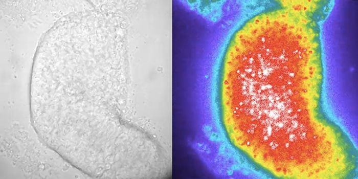 A Human Developmental Clock in a Dish