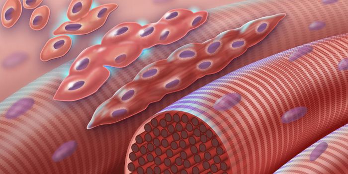 Cause of Carey-Fineman-Ziter Syndrome, Potential Treatment ID'ed
