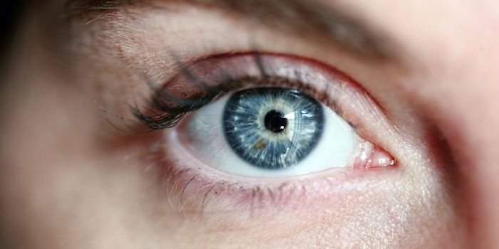 Successful Immunotherapy Outcome for Rare Eye Cancer