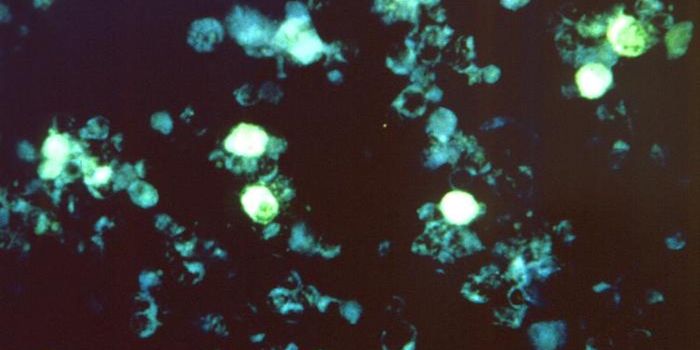 Epstein-Barr Virus Hones in on Fragile DNA to Cause Cancer