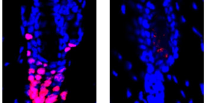 A Link Between Hair Growth and the Immune System is Revealed