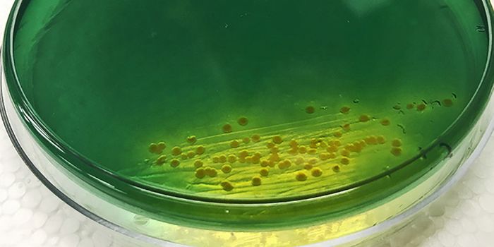 Different strains of cholera use different weapons to kill