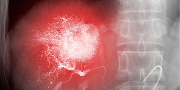 Optical Imaging in Tissue with Near-Infrared Dyes