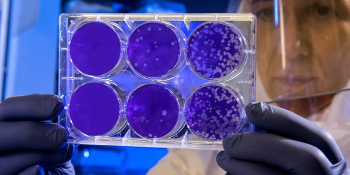 Improving Chemotherapeutic Delivery