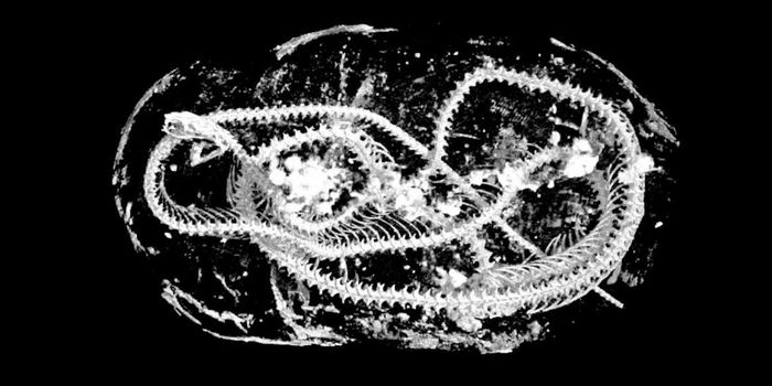 Revealing a Mummy's Secrets With High-Resolution Scans