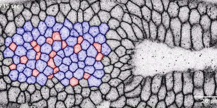 Using Light to Control Organ Development