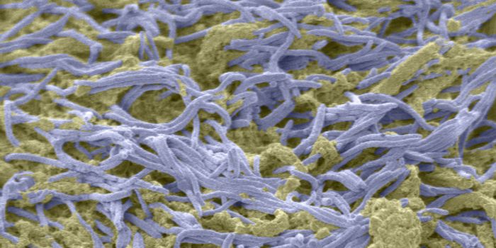 New Model Sheds Light on Managing Biofilms