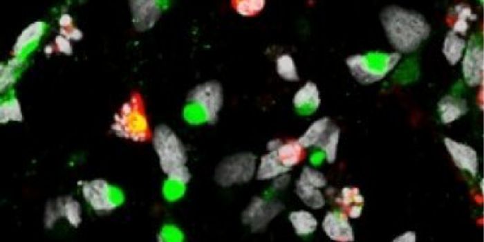 First Experimental Support For Zika's Link To Microcephaly