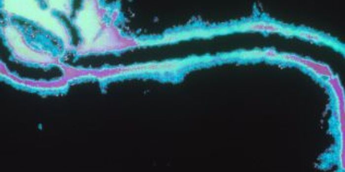 New Ebola Rapid Testing Technologies Will Detect  Surface and Airborne Infectious Viruses Onsite, in Minutes