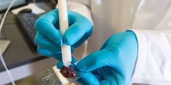 The Pen That Can Instantly Detect Cancer