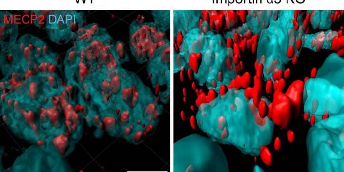 Insights Into the Mechanisms Underlying Anxiety