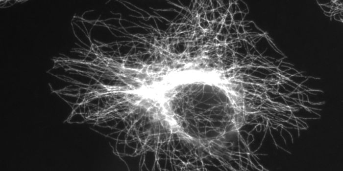 Visualizing Microtubules Without Labeling - a new Technique