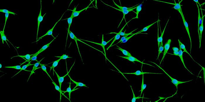 Key Markers in Melanoma Disease Progression