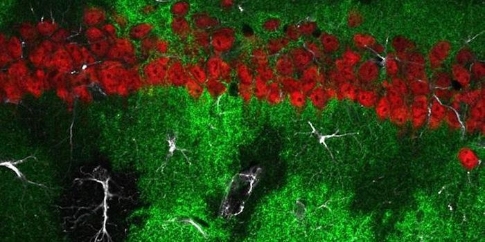 New Connection Between Receptors Discovered in the Brain