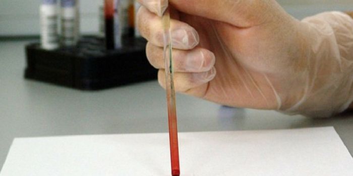 Is Testing Everyone for Hep C Necessary?