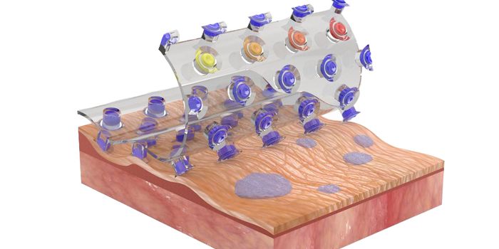Stick-on Diagnostic Patch Inspired by Beetles