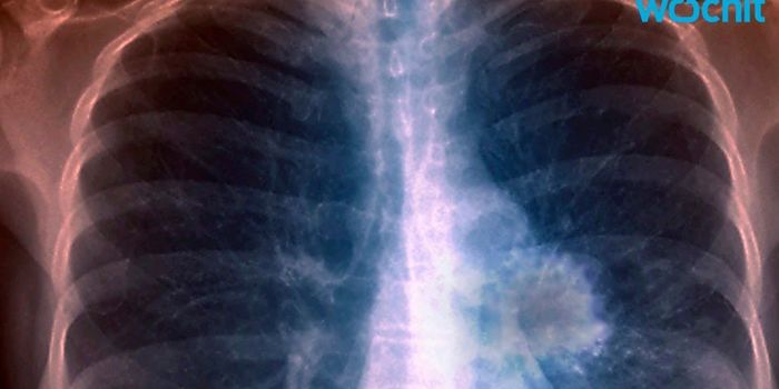 Lung Cancer Doesn't Just Strike Smokers