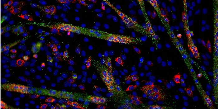 microRNA Provides Insight Into the Mechanisms of Schizophrenia