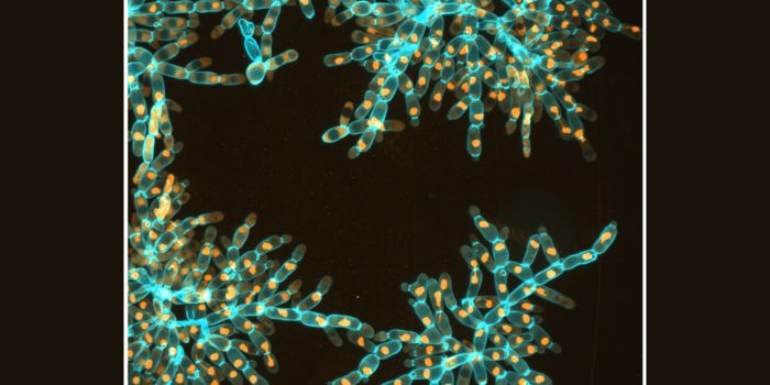 The Evolution of a Kind of Multicellular Life is Recreated in the Lab