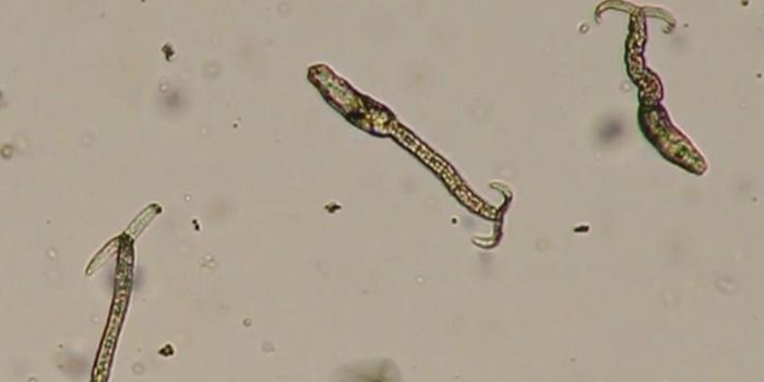 Heat Shock Protein may Trigger Parasitic Invasion