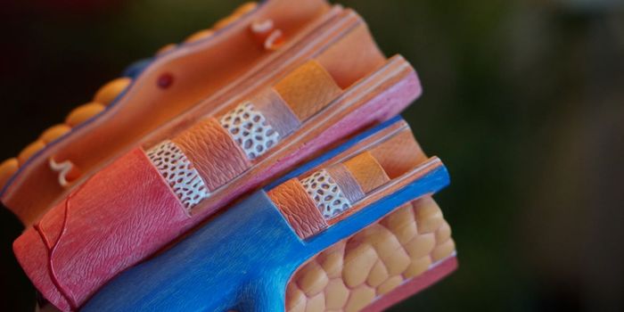 Does Exercise Accelerate Atherosclerosis?