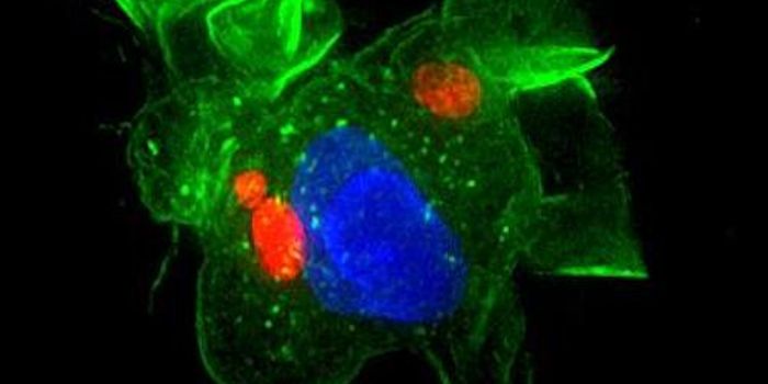 Cats Carry a Parasite That can Reach the Brain