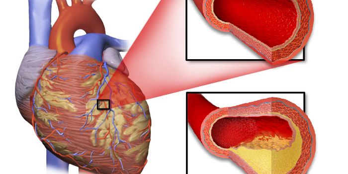 New System Limits Cardiac Damage with Rapid Response