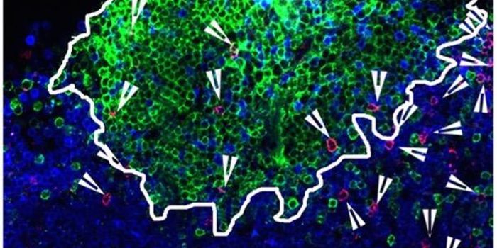 Exposing HIV Reservoirs For Killer T Cells