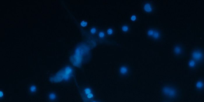 Adults with Heart Defects More Likely to Have Dementia