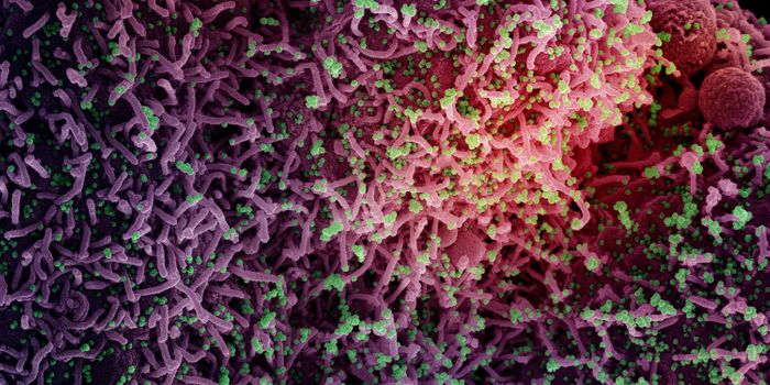 A Genetic Variant Can Protect Against Severe COVID-19