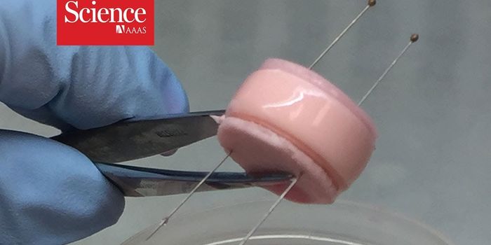 Developing Tissue-engineered Discs to Treat Bad Backs