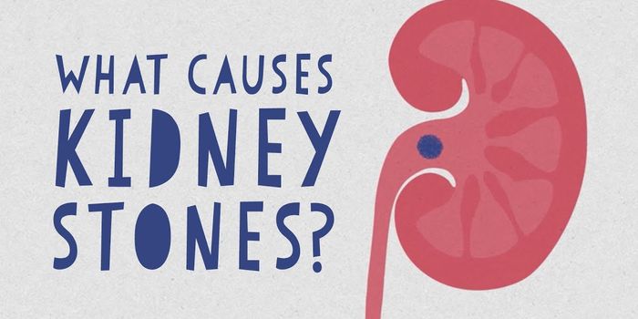 What Causes Stones to Form in Your Body?