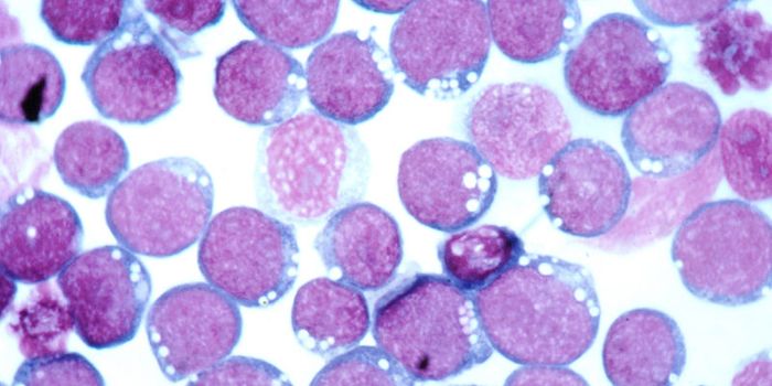 Severity of Mono Linked to Cross-Reactive T Cell Activity