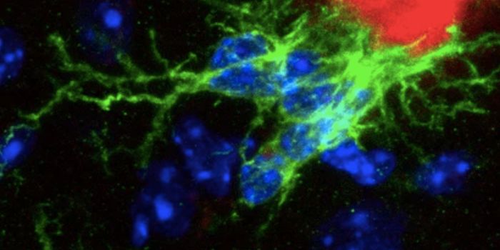 Bacteria in the Lungs Can Impact Immune Cells in the Brain