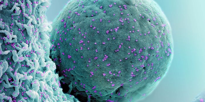 A Cause of Long COVID Brain Fog is Revealed