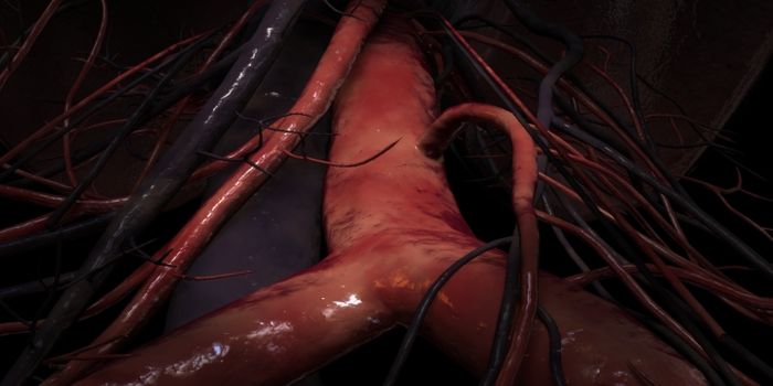 New Gene Linked to Human Aortic Aneurysms
