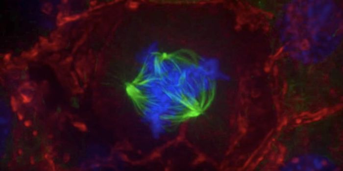 How Cells Eliminate Chromosome Imbalances